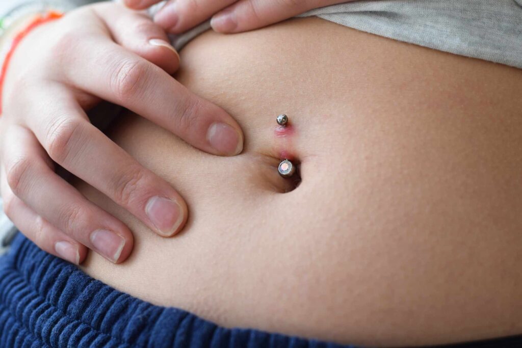 Is Your Belly Button Piercing Being Rejected? Here’s How To Tell and What To Do Is Your Belly Button Piercing Being Rejected? Here's How To Tell and What To Do