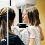 Millions of breast cancer patients could safely avoid chemotherapy, study suggests