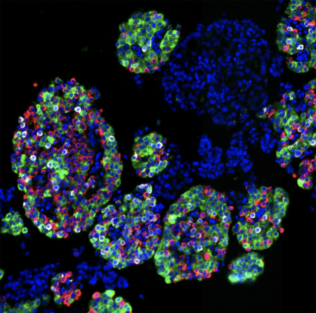Isolated islets showing cell nuclei (blue) and three main endocrine cell types: insulin-producing beta cells (green), glucagon-producing alpha cells (red), and somatostatin-producing delta cells (white).