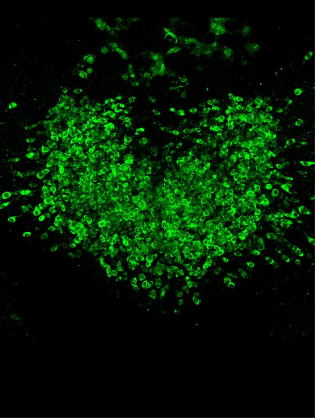 Fluorescence indicates heterogeneous calcium activity in hundreds of area postrema neurons