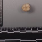 Protein in Homo erectus teeth suggests Denisovans gave us some of their DNA
