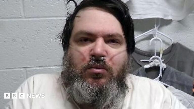 A man with black hair and a long black/grey beard has a breathing tube in his nose