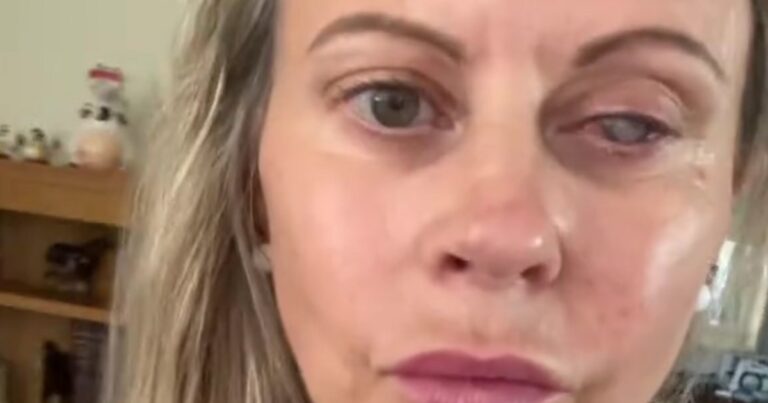 Brits warned after mum of three’s eye eaten by parasites after mistake | UK | News