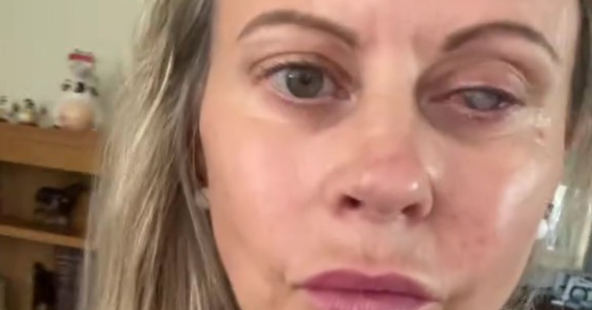 Brits warned after mum of three’s eye eaten by parasites after mistake | UK | News