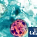 US cyclosporiasis outbreak kills two people in Michigan, officials say
