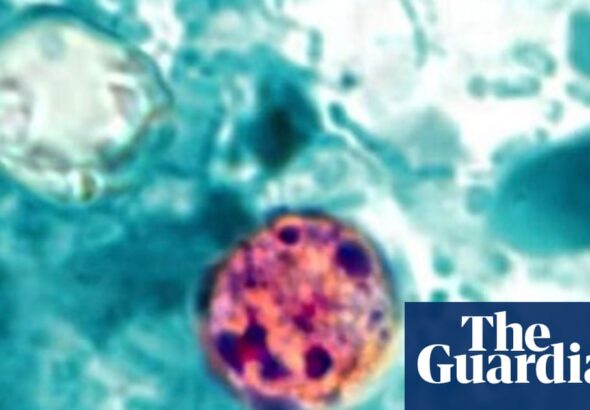 US cyclosporiasis outbreak kills two people in Michigan, officials say