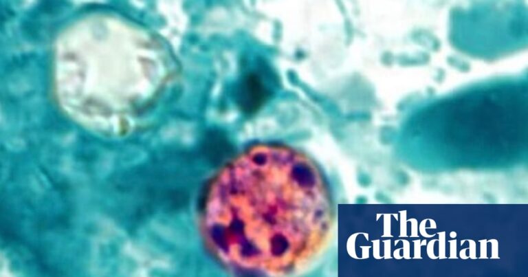 US cyclosporiasis outbreak kills two people in Michigan, officials say